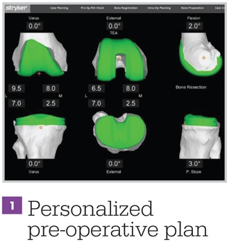 Personalised Preoperative Plan