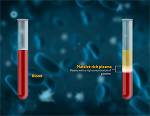 PurePRP