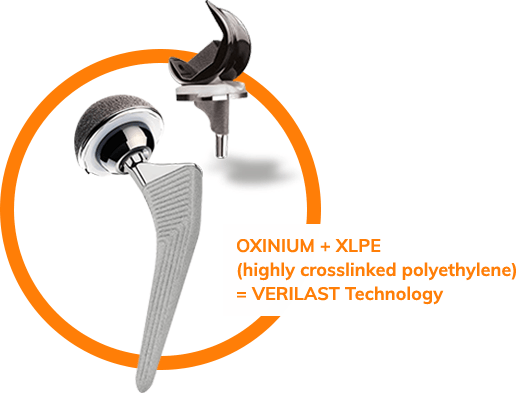 Verilast Implant Technology