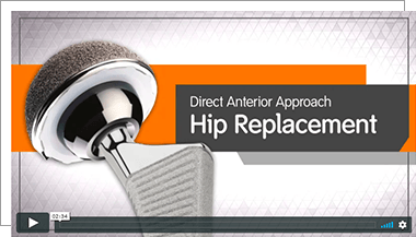 Direct Anterior Total Hip Replacement